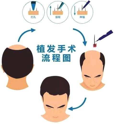 治疗脱发最新药物的研究进展与应用概述